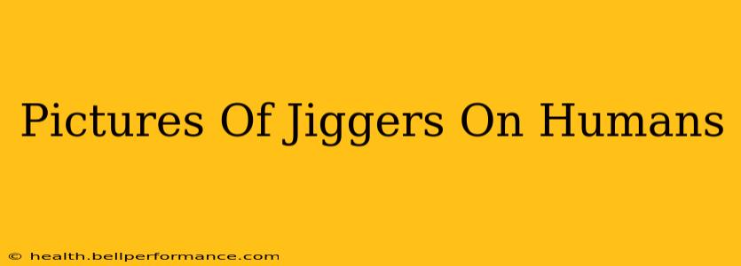 Pictures Of Jiggers On Humans